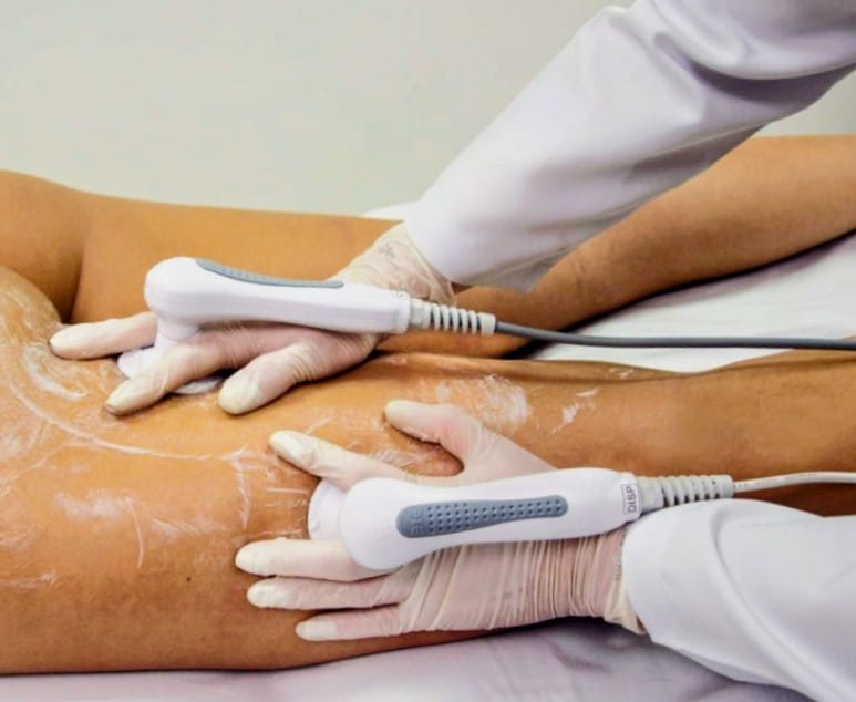 Tecarterapia